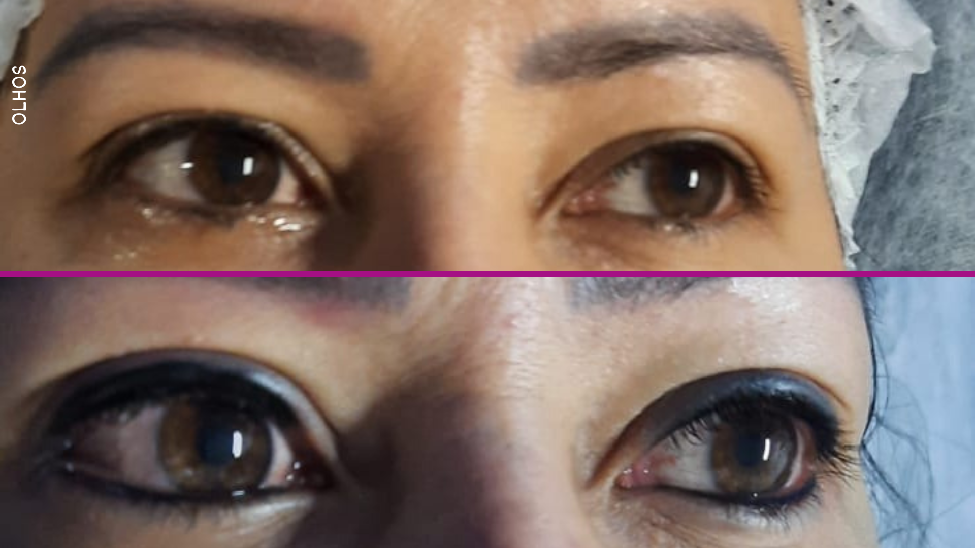 Olhos